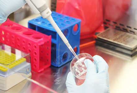 Meme büyütme ameliyatı yapılmadan önce hastanın testlerinin incelenmesi